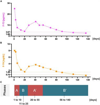 Case report: Impact of hyperthyroidism on psychotic symptoms in schizophrenia comorbid with Graves’ disease